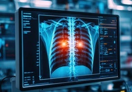 IA que lee radiografías, el 'segundo par de ojos' que revoluciona las urgencias