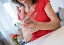 Una mujer con artritis reumatoide, en una imagen de archivo.