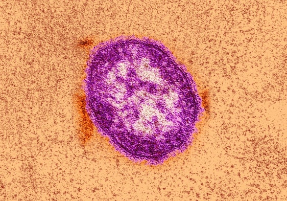 Measles: symptoms, how it is transmitted and the current situation in Andalucía